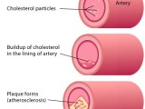 The Hidden Dangers of High Cholesterol Drugs