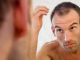 Drugs for Male Pattern Baldness Treatment