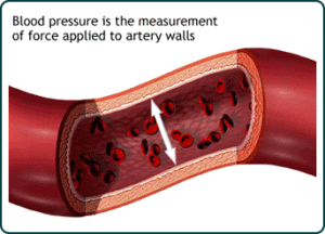 High Blood Pressure and Angina-TrueMedCost
